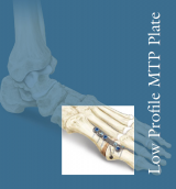 Low Profile MTP Plate