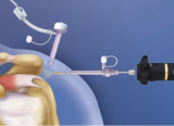 Sheathless Arthroscopy